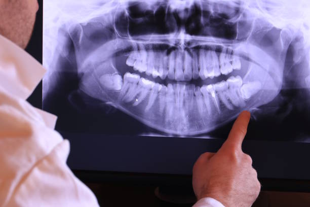 Best Knocked-Out Tooth Emergency  in Cheree, OK
