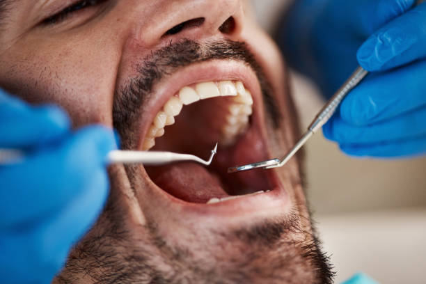 Best Cracked Tooth Emergency Dentist  in Cheree, OK
